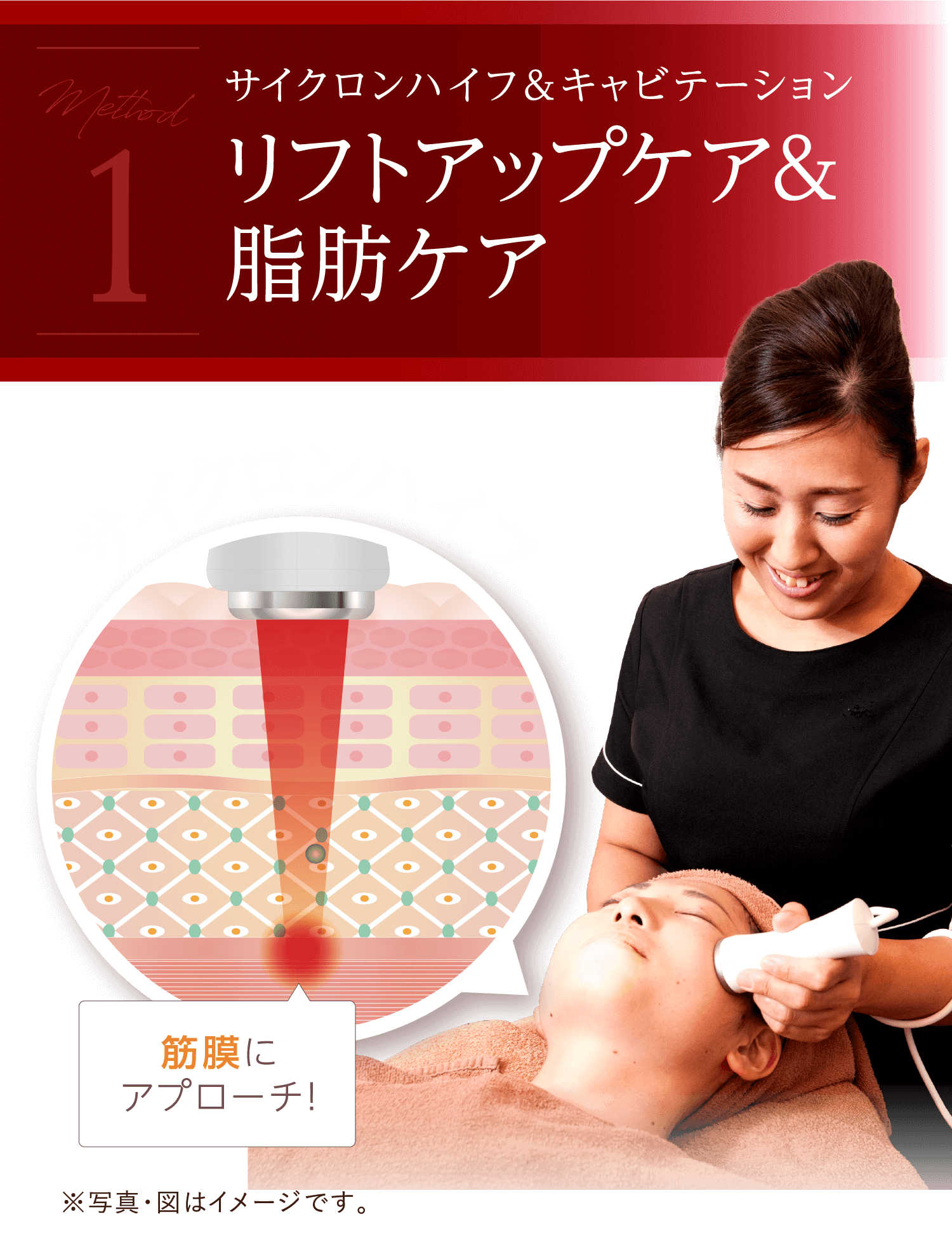 Method1 サイクロンハイフ&キャビテーション リフトアップケア＆脂肪ケア サイクロンハイフ 筋膜にアプローチ！※写真・図はイメージです。
