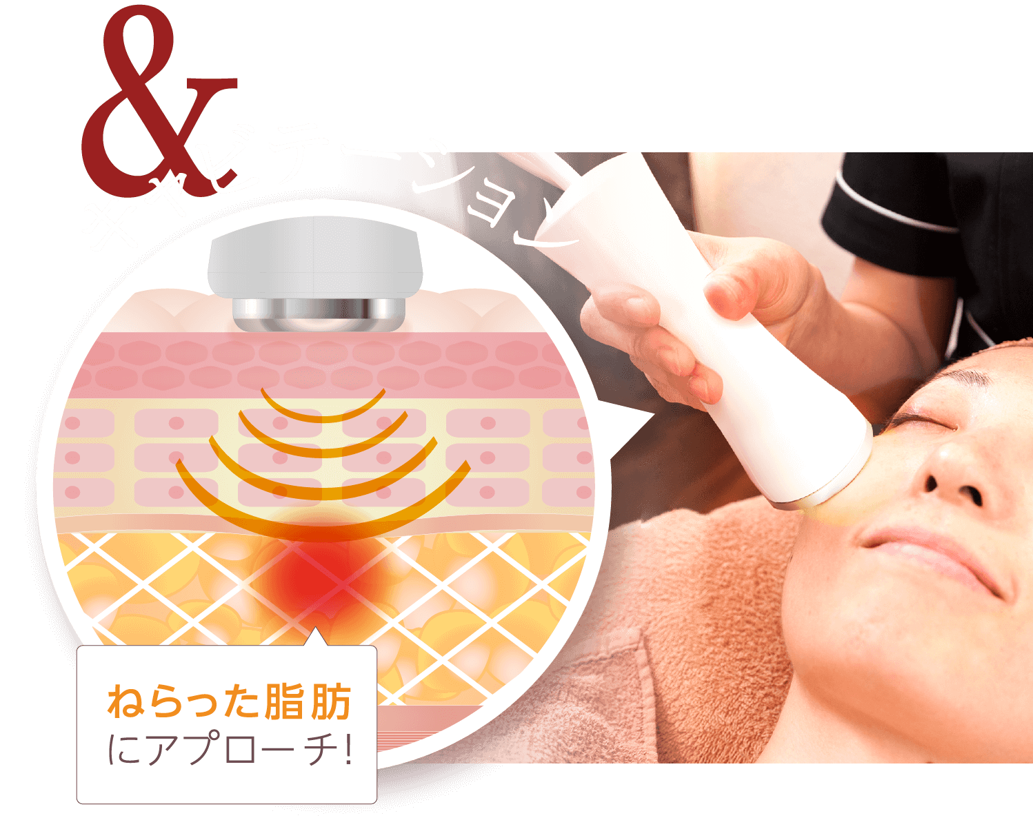 & キャビテーション ねらった脂肪にアプローチ！